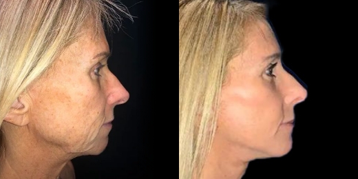 Greenberg Cosmetic Surgery & Dermatology Before After Slide