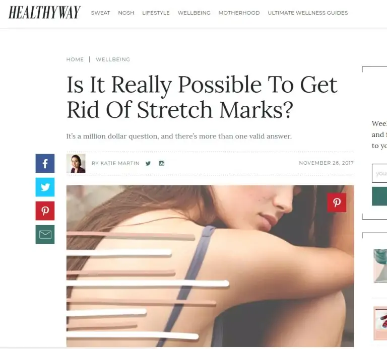 Is It Really Possible To Get Rid Of Stretch Marks?