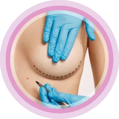 Woman with markings below her breast