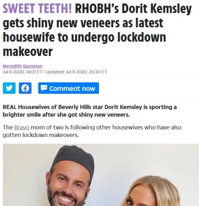 Sweet Teeth! Rhobh’s Dorit Kemsley Gets Shiny New Veneers As Latest Housewife To Undergo Lockdown Makeover