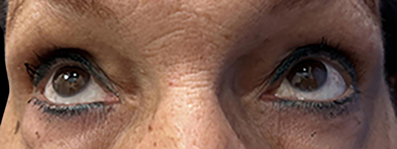 Case--21939 | Before Face