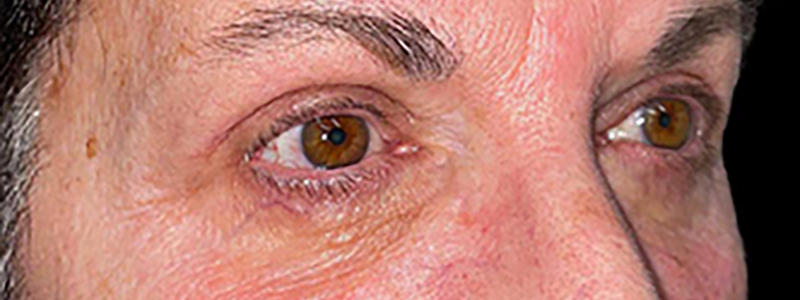 Case--21940 | Before Face