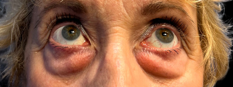 Case--4893 | Before Face