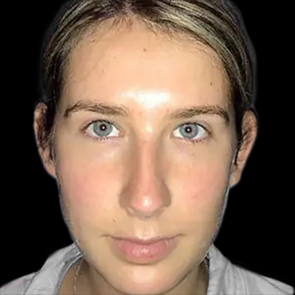 Case--21170 | Before Face