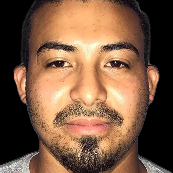 Case--21164 | Before Face