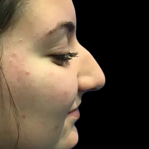 Case--21203 | Before Face