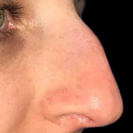 Case--21173 | Before Face