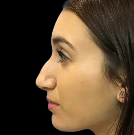 Case--21193 | Before Face