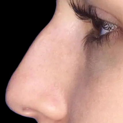 Case--21194 | Before Face