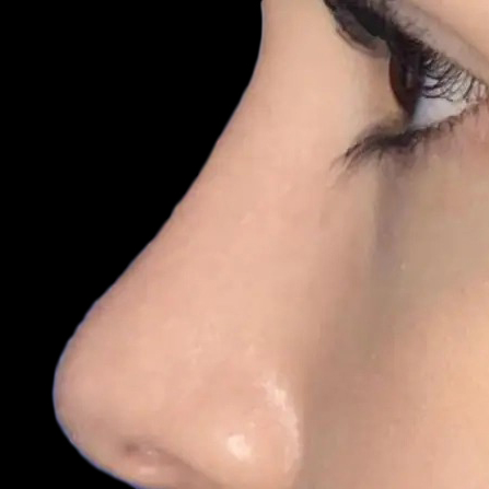 Case--21194 | After Face