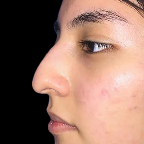 Case--21201 | Before Face