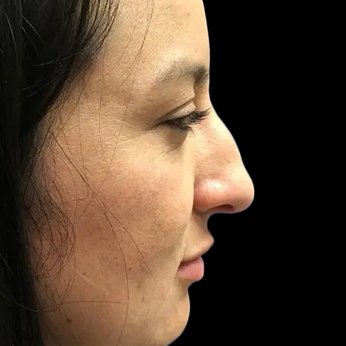 Case--21209 | Before Face