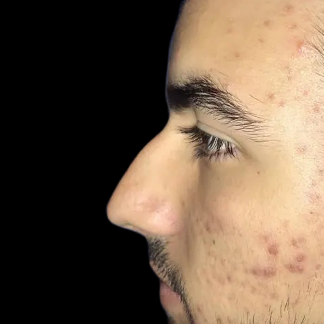 Case--21202 | Before Face