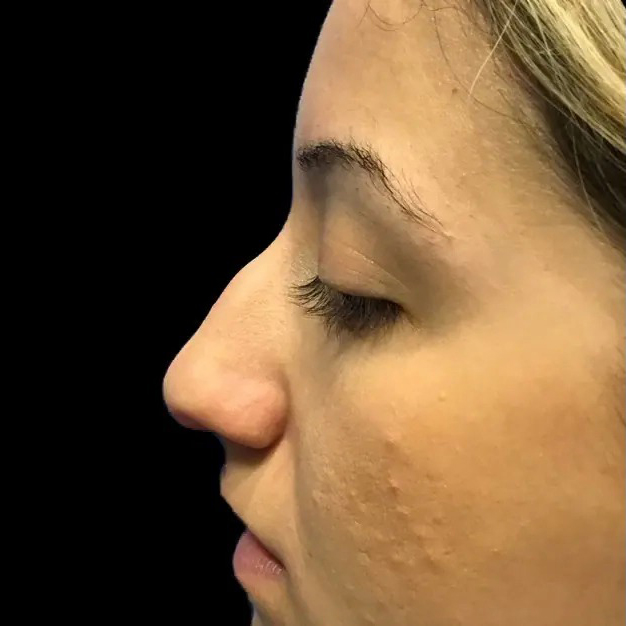 Case--21220 | Before Face