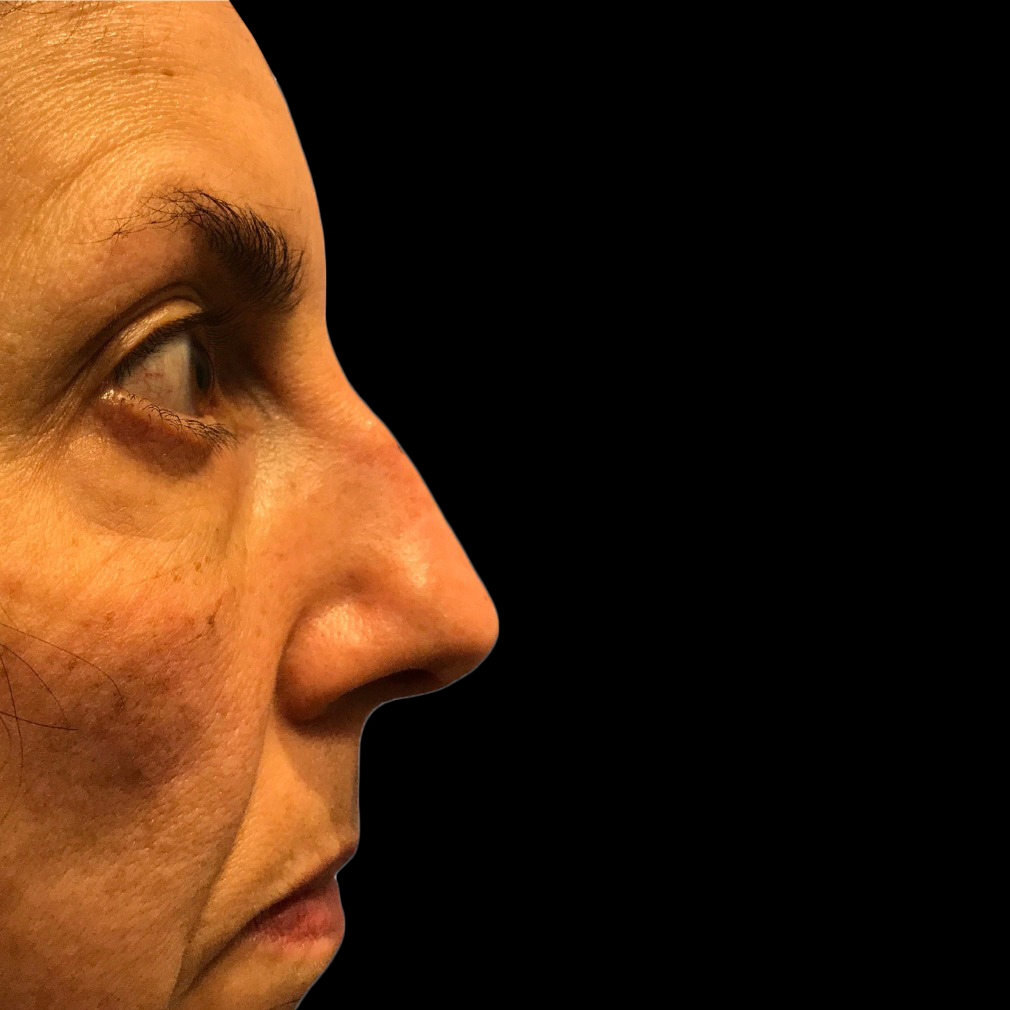 Case--21227 | Before Face