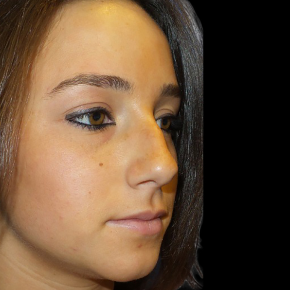 Case--21234 | Before Face