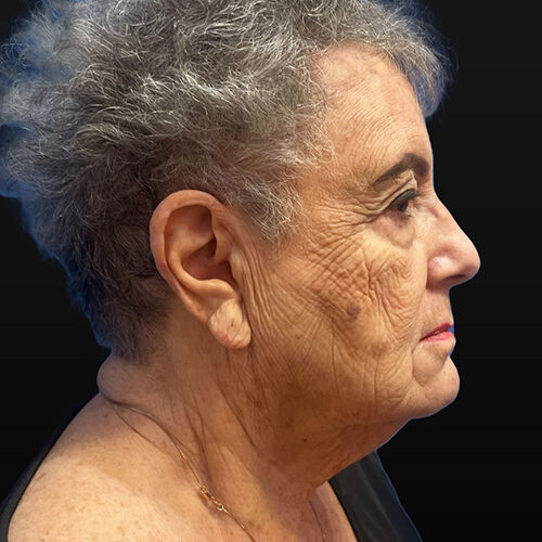 Case--6773 | Before Face