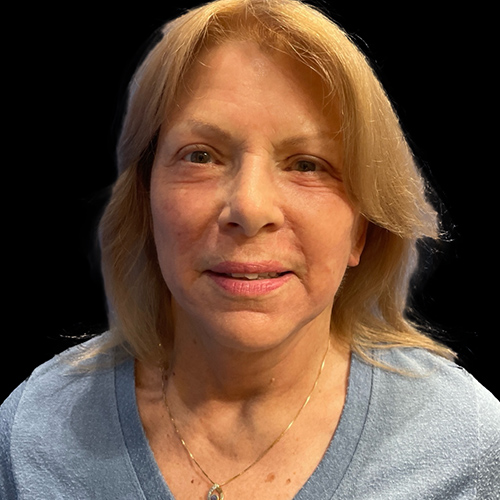 Case--1789 | After Face