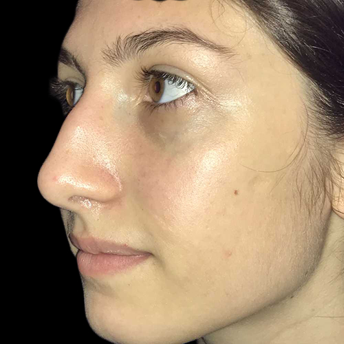 Case--19270 | Before Face