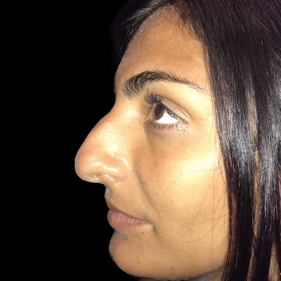 Case--19273 | Before Face