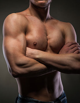 Gynecomastia